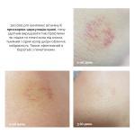 Ампула з ліпосомальною формулою вітаміну K Dr. Ceuracle PLC Vita K Liposome Oil Ampoule, 50 мл